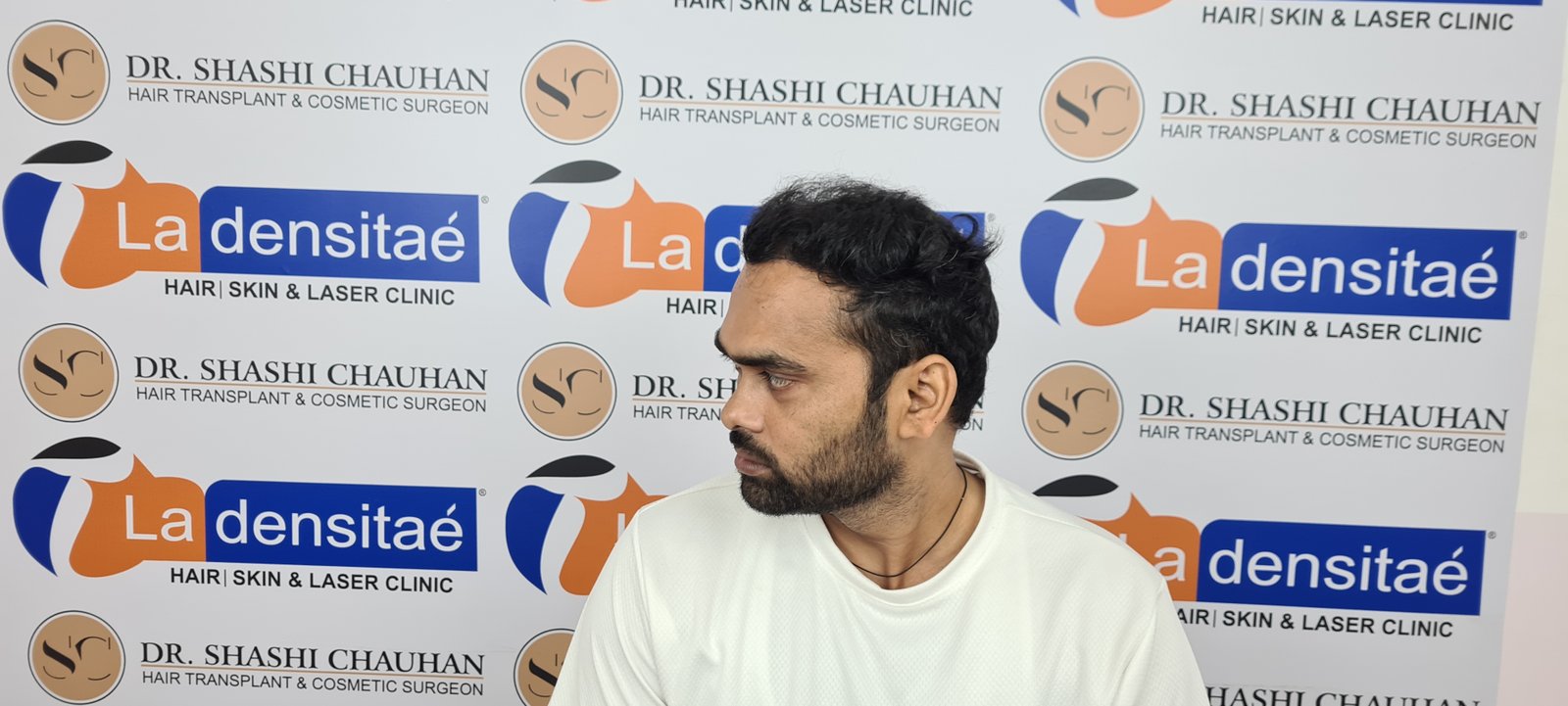 Anesh Kumar After Hair Transplant
